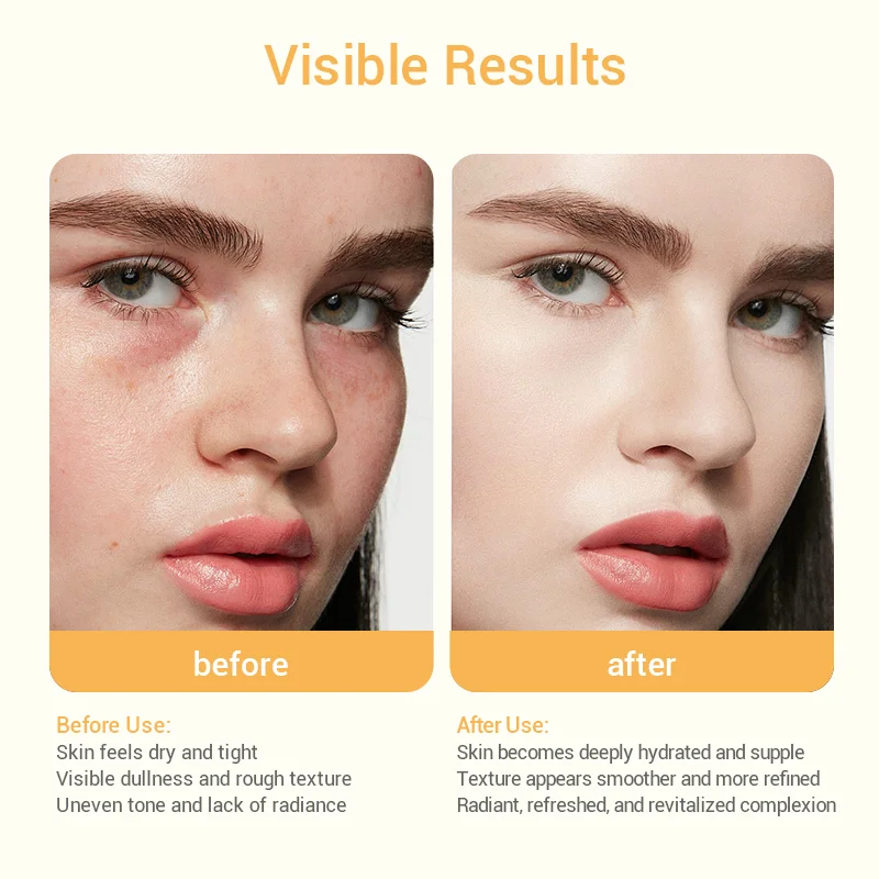Before and after skincare results showing textural and tone improvements. Skin appears more hydrated and radiant after use.
